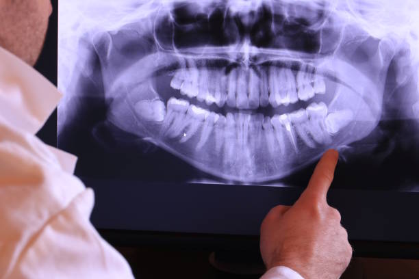 Best Emergency Dental Care for Broken or Chipped Teeth in Glenn Heights, TX